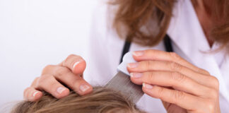 Kiedy można zarazić się wszami i jak można je skutecznie usunąć