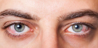 Przyczyny zespołu suchego oka