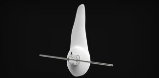 Jaki aparat ortodontyczny dla 7 latka?